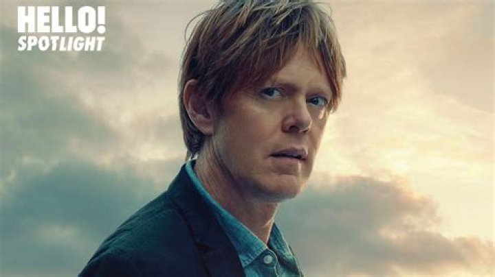 Kris Marshall Face Surgery: Unpacking the Rumors and Real Story